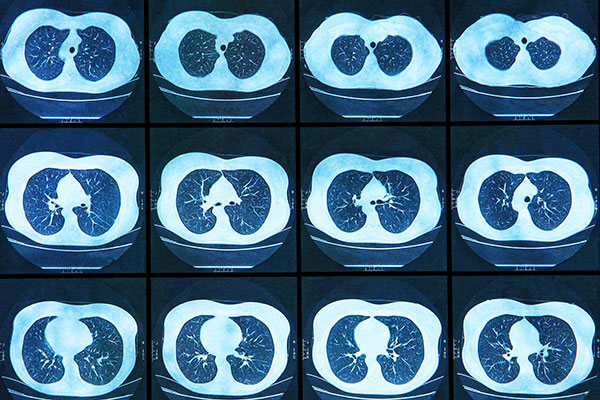 Scans of a spinal cord.